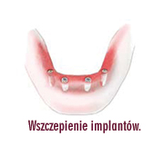 [Rozmiar: 25840 bajt�w]