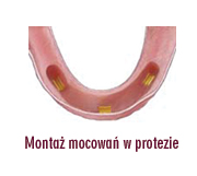[Rozmiar: 25840 bajt�w]