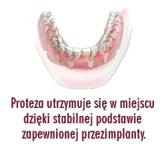 [Rozmiar: 25840 bajt�w]