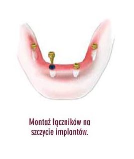 [Rozmiar: 25840 bajt�w]